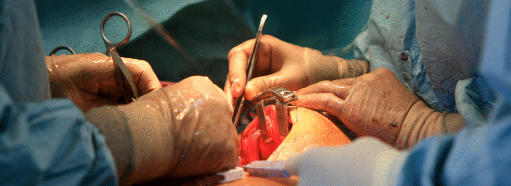 Best Gynecomastia Surgery in Bangalore