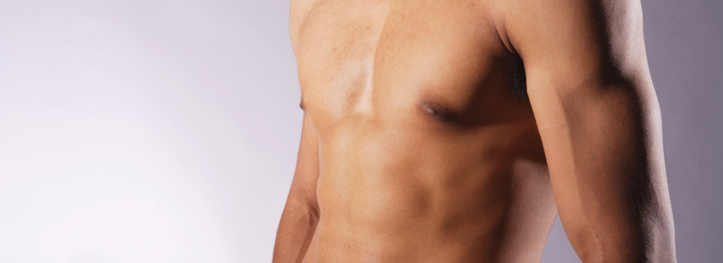 gynecomastia surgery
